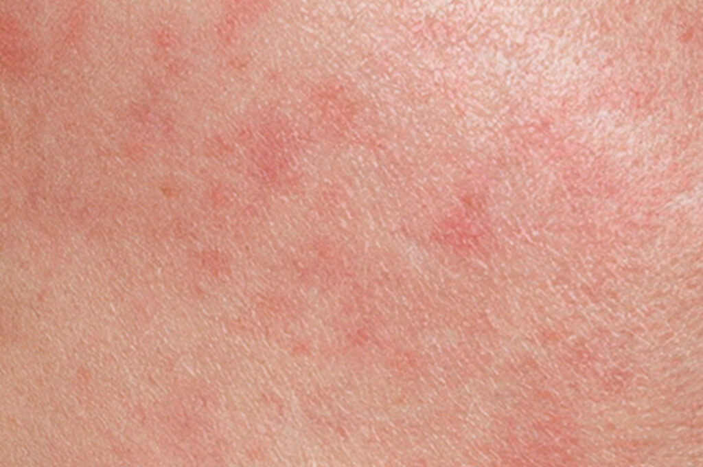 rutina piel sensible