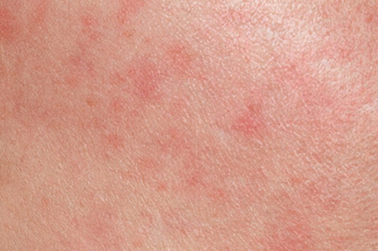 rutina piel sensible